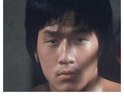 探寻小巷中的美丽秘密，割双眼皮的价格是否昂贵？